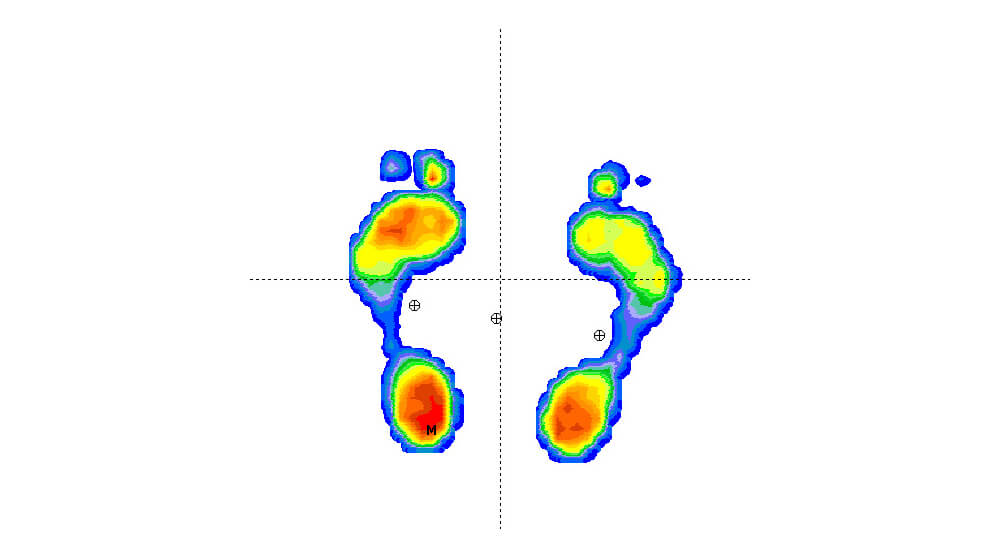 Ganganalyse bij Podozorg Amsterdam