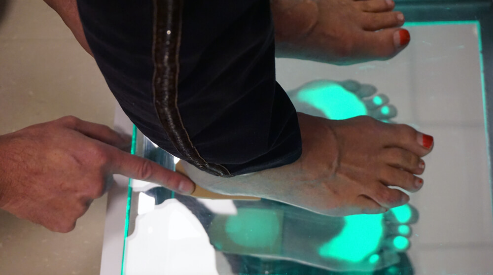 Podobaroscoop onderzoek bij Podozorg Amsterdam